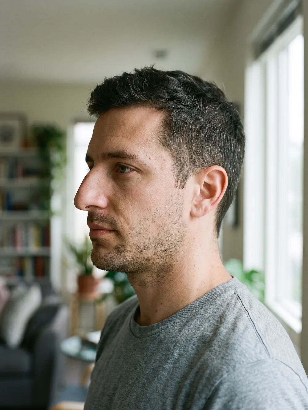 Male profile with a dorsal hump before rhinoplasty