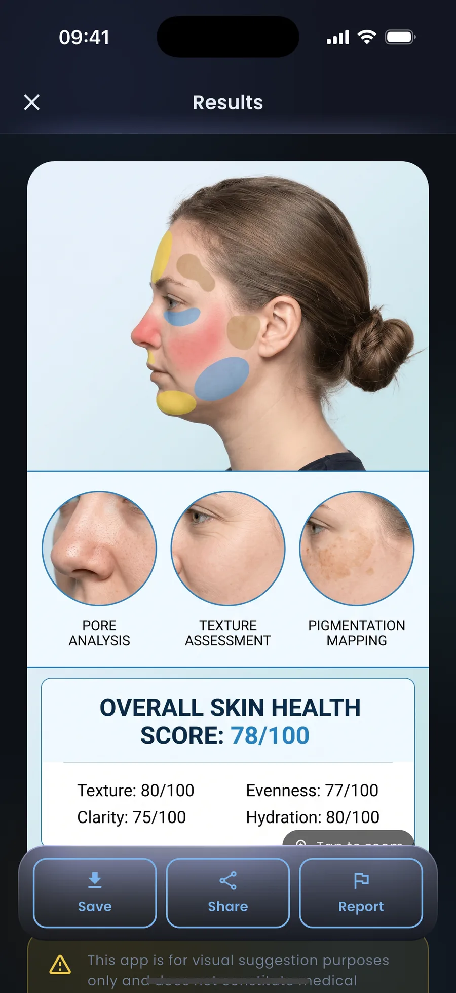 AI skin analysis result with concern zones and scores