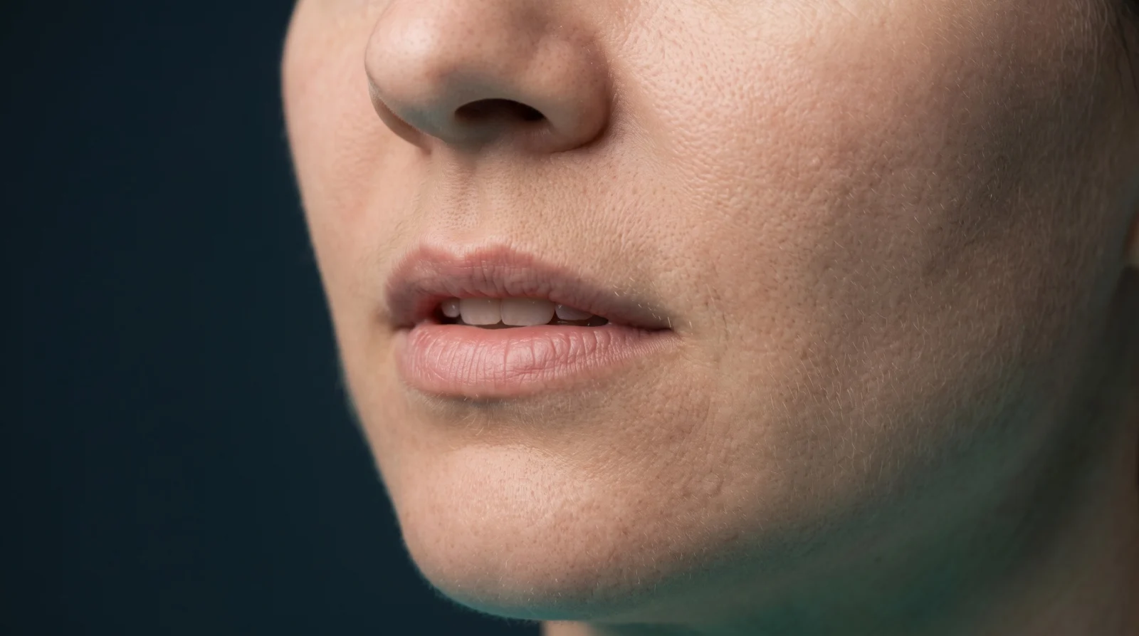 Close-up of an adult woman's relaxed upper lip and philtrum in soft daylight