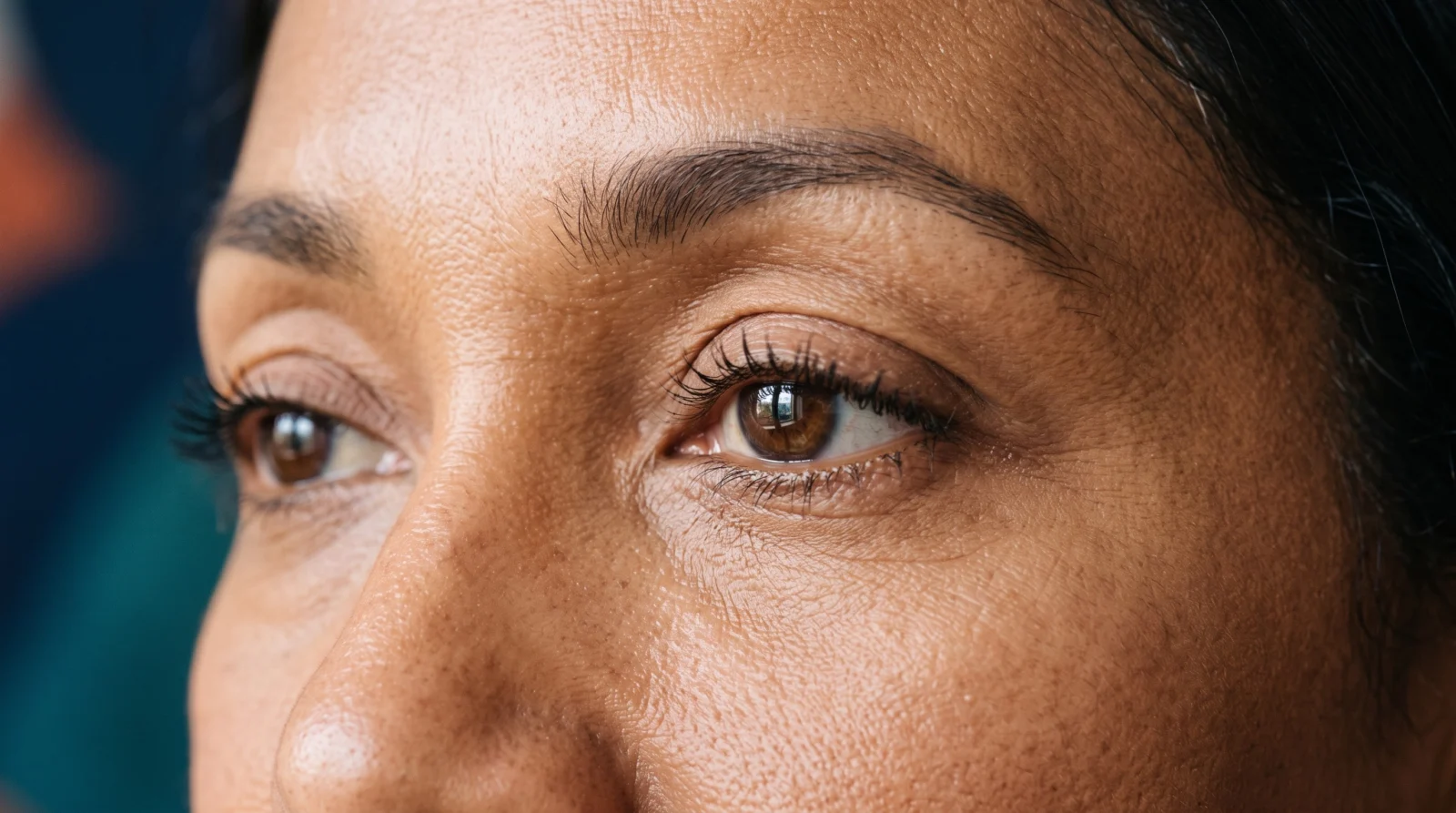 Upper Blepharoplasty vs Brow Lift: Fixing Hooded Eyelids