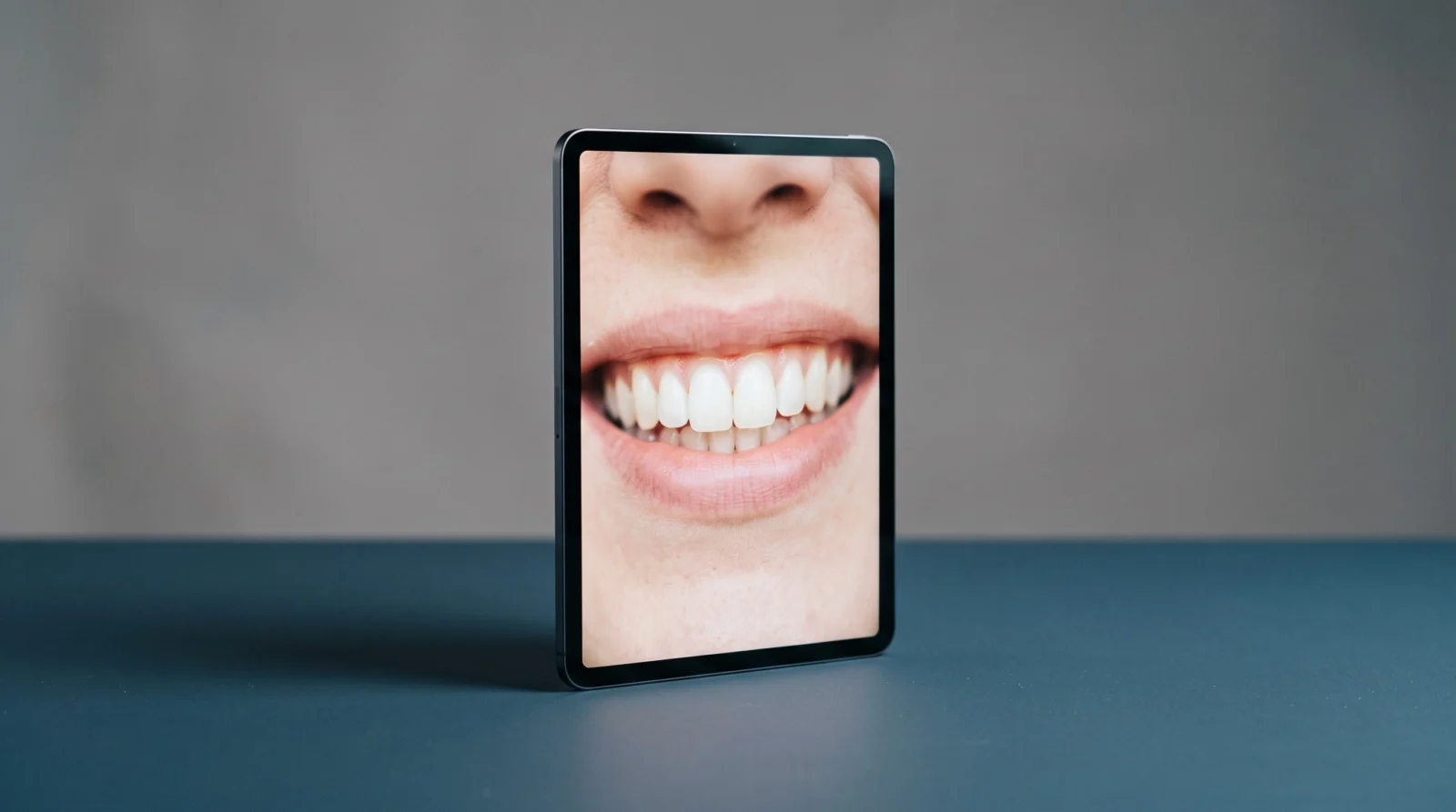 Dental shade guide and digital smile mockup on a tablet